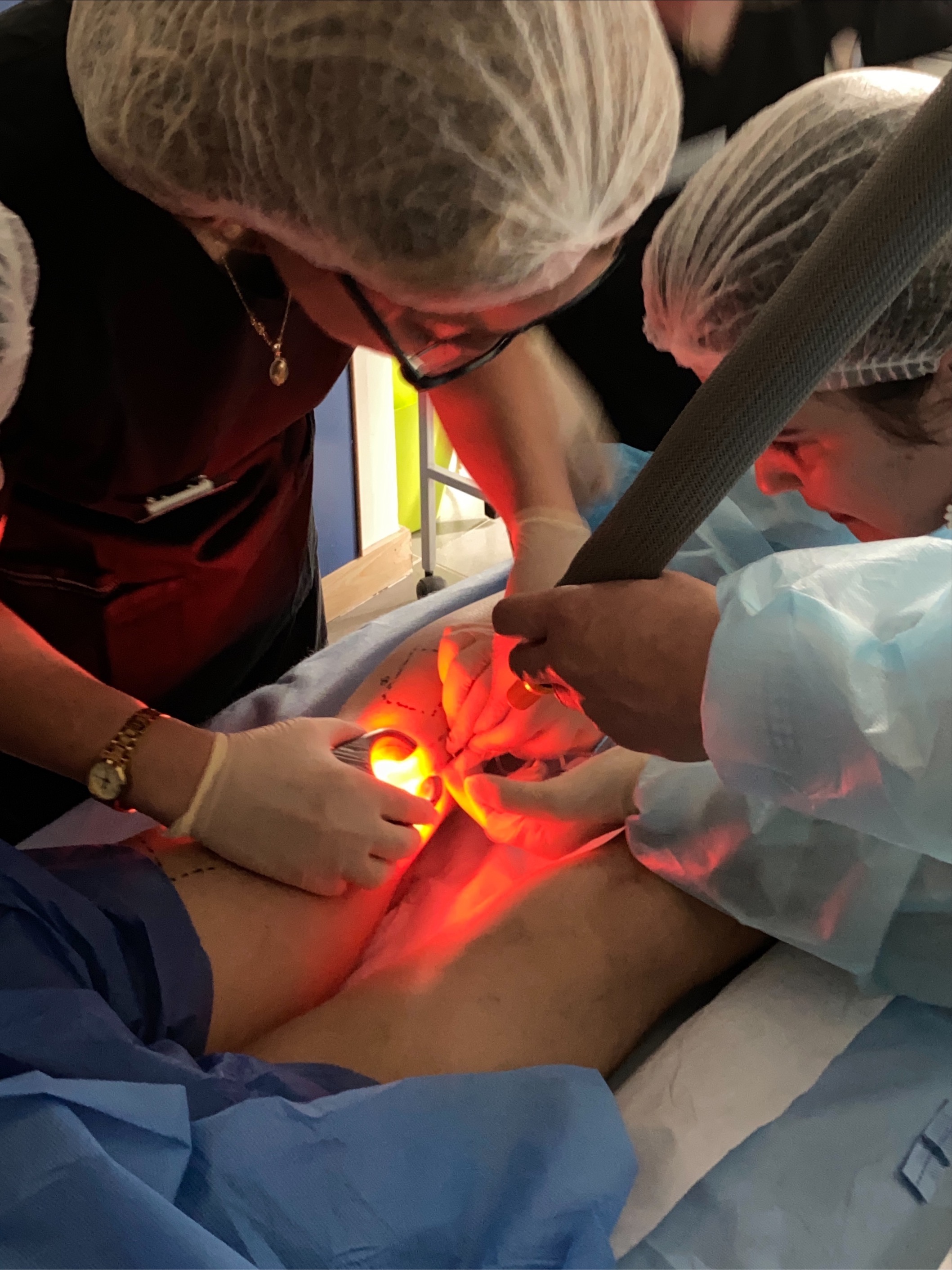 Sclerotherapy workshop procedure at AdventHealth Nicholson Center